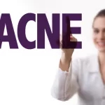 Faq acne