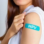 Infezione da Papilloma virus HPV